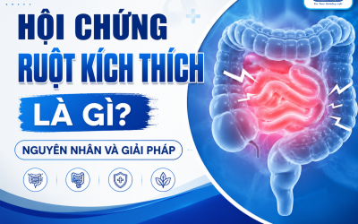 Hội chứng ruột kích thích là gì? Nguyên nhân và giải pháp toàn diện