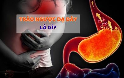 Trào ngược dạ dày là gì? Nguyên nhân, biện pháp khắc phục